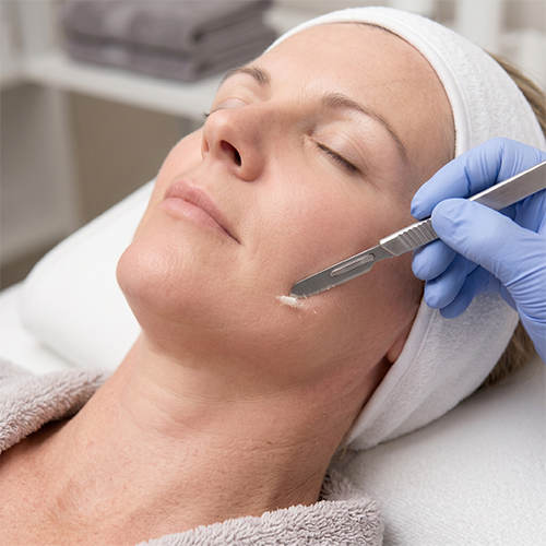 Dermaplaning